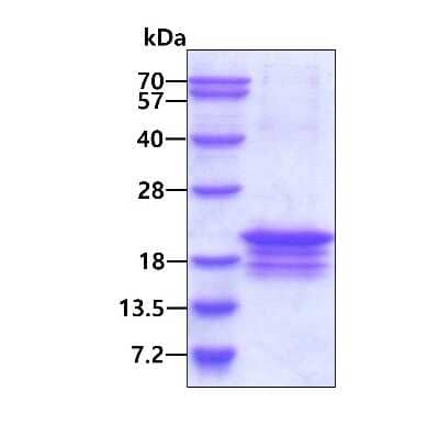 SDS-PAGE: Recombinant Human DNA Polymerase epsilon subunit 3 His Protein [NBP2-23341]